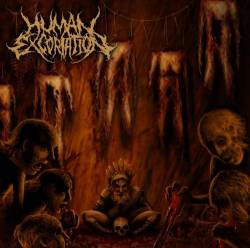 Human Excoriation : Virulent Infestation